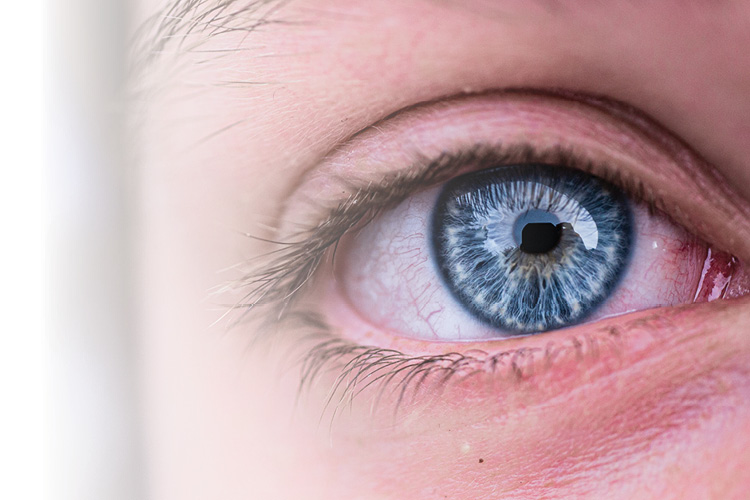 Herbal Reconnection Eye Iridology